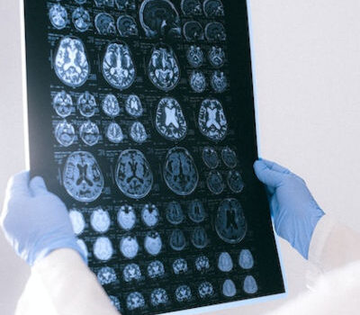 brain-chart an x-ray of brains